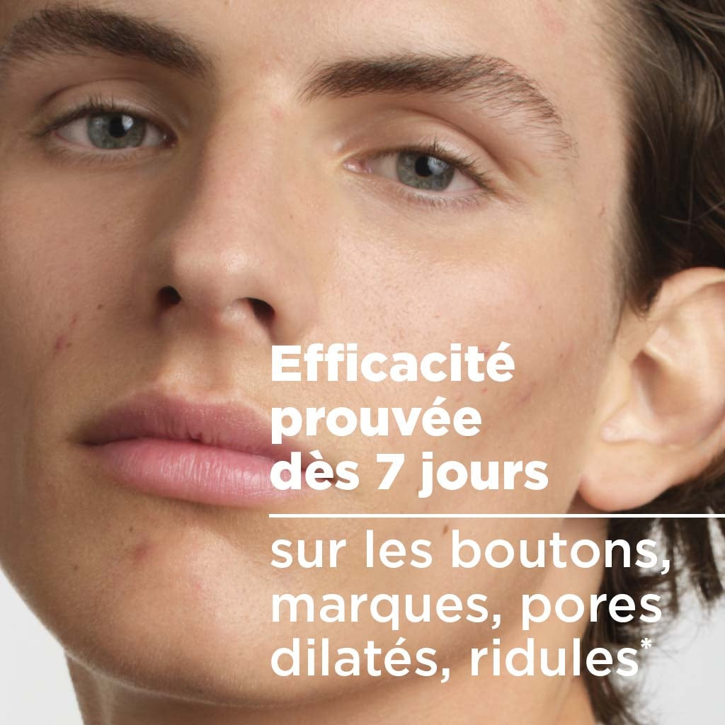 Bioderma Sébium Night Peel Overnight Resurfacing Treatment