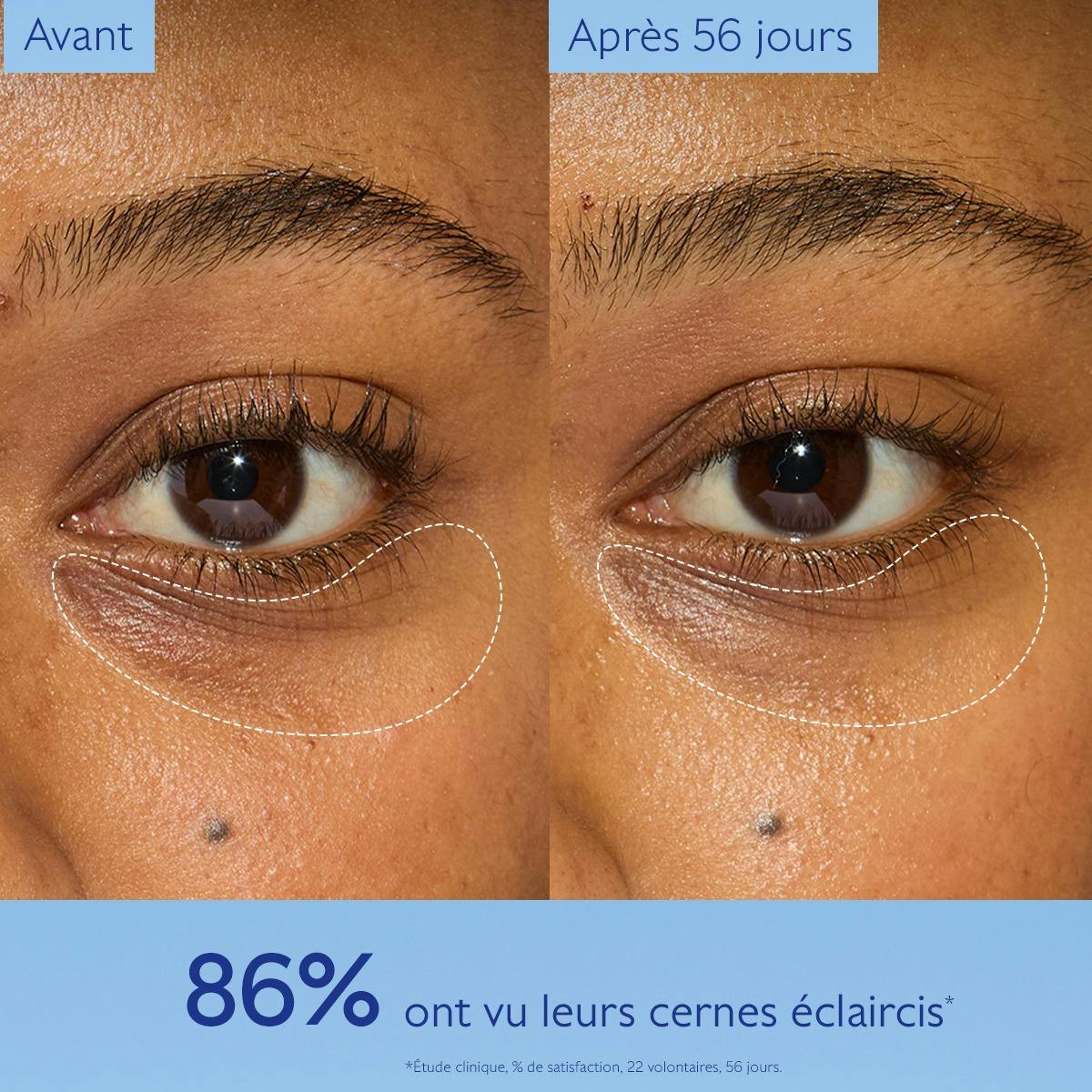 Caudalie Vinoperfect Dark Circle Brightening Eye Cream
