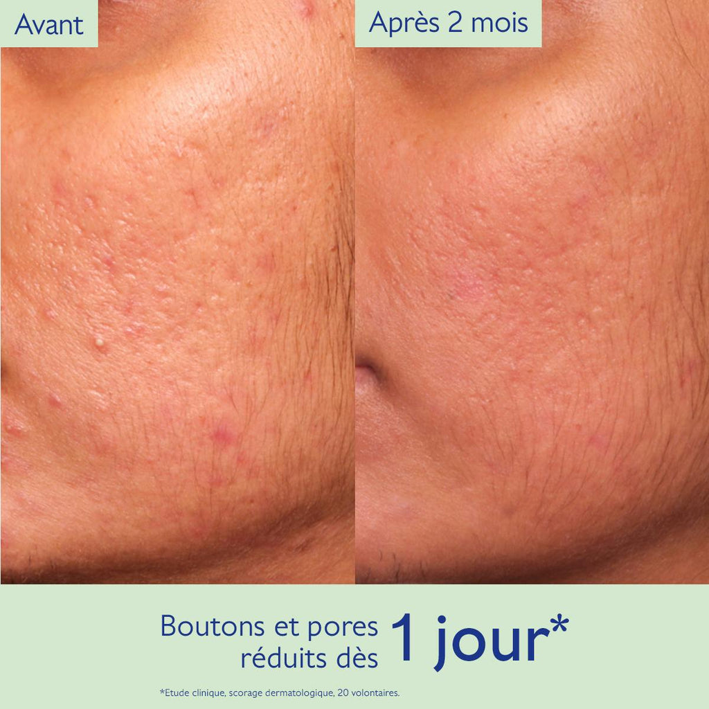 Caudalie Vinopure Natural Salicylic Acid Pore Minimizing Serum