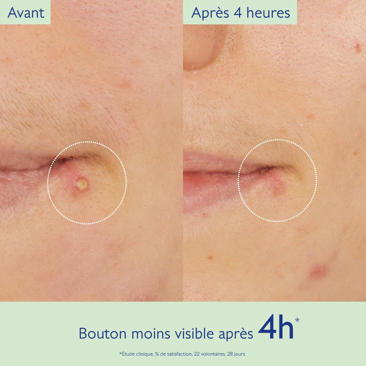 Caudalie Vinopure Salicylic Pimple Stopper Spot Treatment