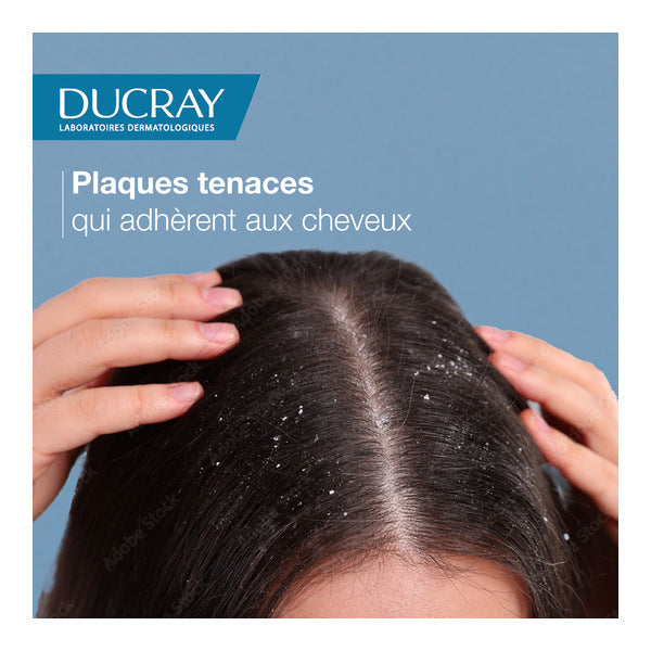 Ducray Squanorm Anti-Dandruff Shampoo for Oily Dandruff
