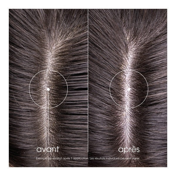 Klorane Cedar Shampoo for Normal to Oily Hair