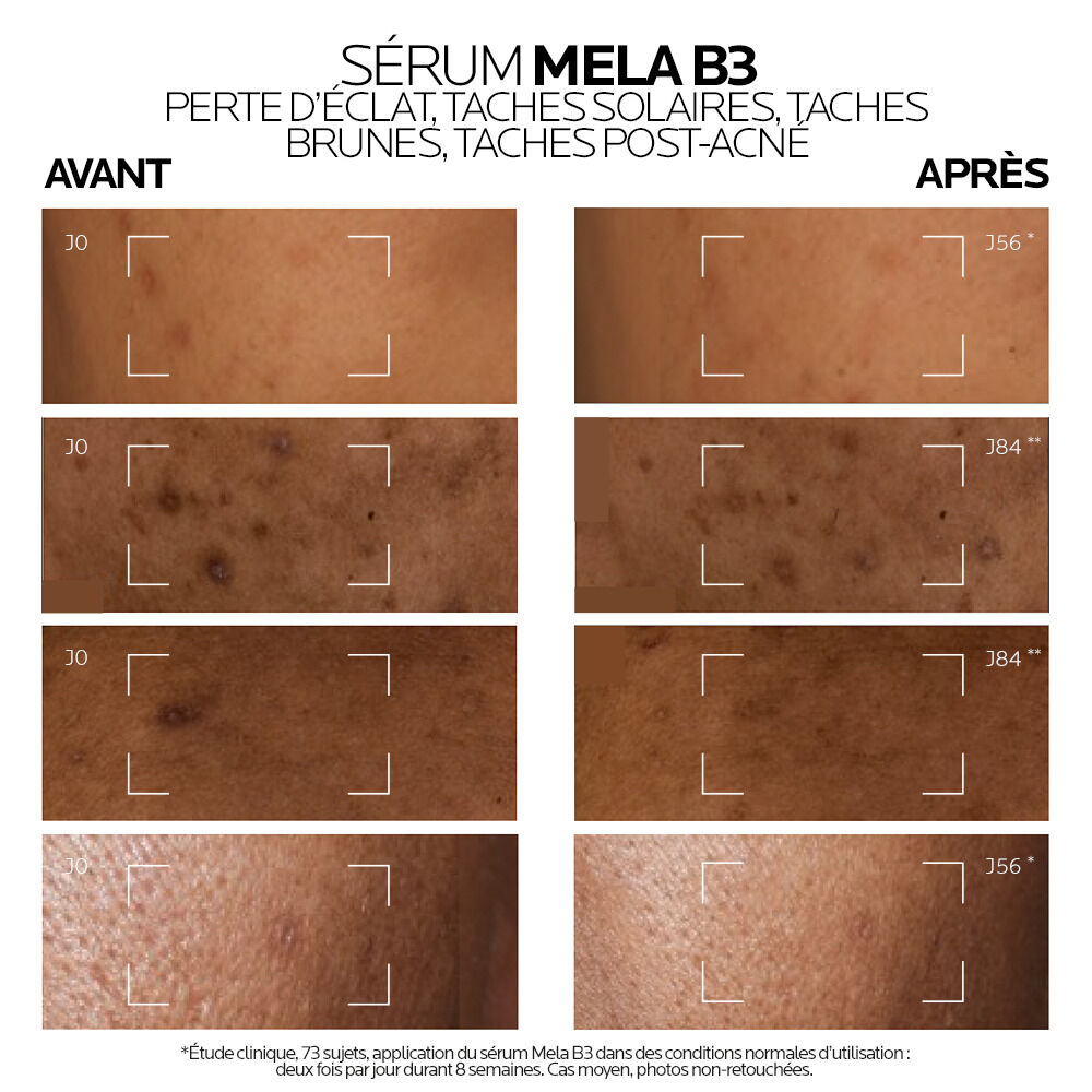 La Roche-Posay Mela B3 Intensive Anti-Spot Serum