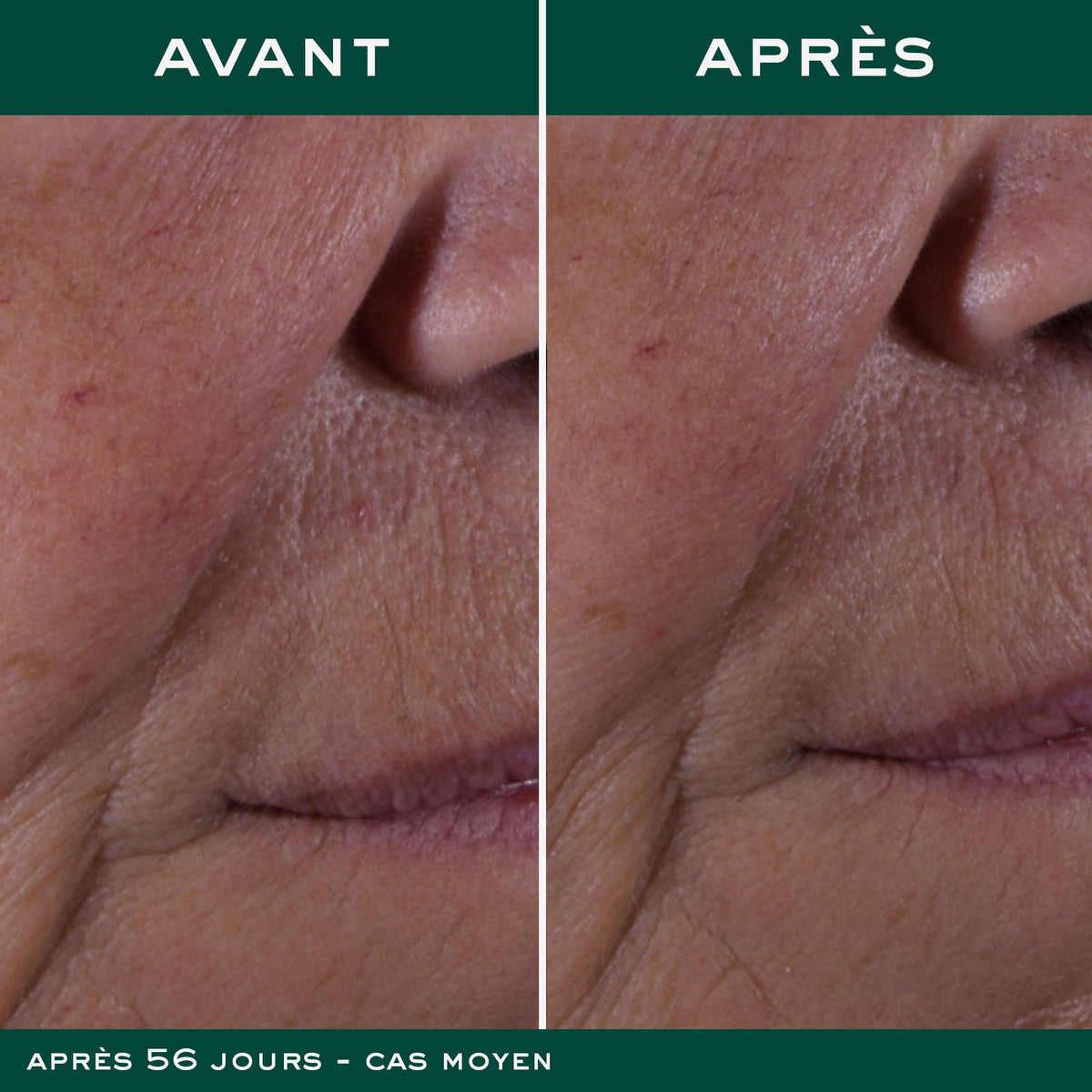 NUXE NUXURIANCE ULTRA Crème-Fluide Redensifiante Anti-Âge Global