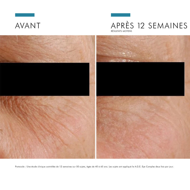 SkinCeuticals Age Eye Complex Anti-Wrinkle Eye Cream