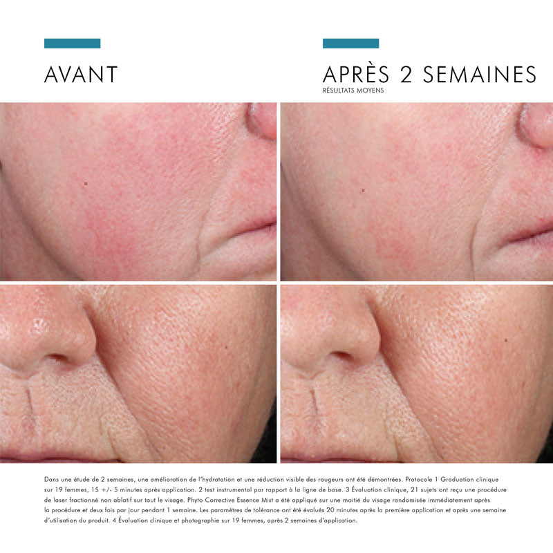 SkinCeuticals Phyto Corrective Essence Soothing Mist