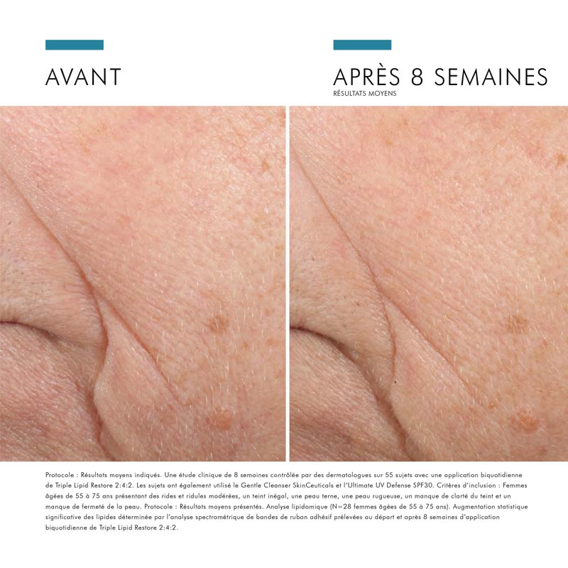 SkinCeuticals Triple Lipid Restore 2:4:2 Anti-Aging Barrier Cream
