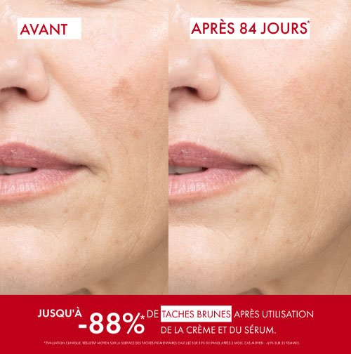 Vichy Liftactiv B3 Anti-Spot Day Cream SPF 50